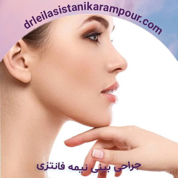 جراحی بینی نیمه فانتزی - دکتر لیلا سیستانی کرم پور