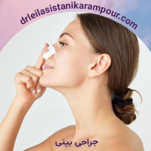 جراحی بینی - دکتر لیلا سیستانی کرم پور
