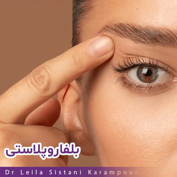 بلفاروپلاستی - دکتر لیلا سیستانی کرم پور