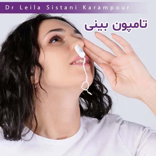 تامپون بینی - دکتر لیلا سیستانی کرم پور