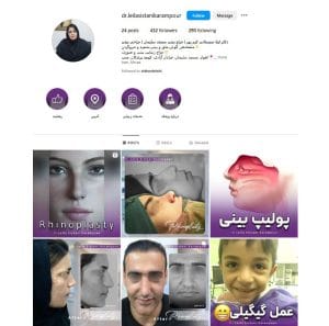 بهترین جراح بینی مسجد سلیمان - دکتر لیلا سیستانی کرم پور