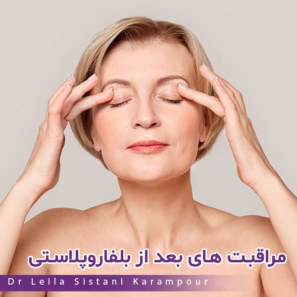 مراقبت های بعد از جراحی پلک - دکتر لیلا سیستانی کرم پوز