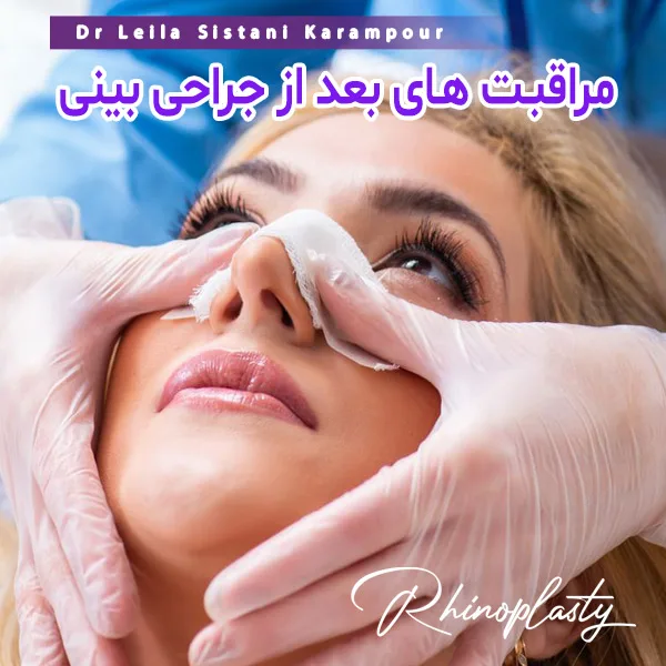 مراقبت های بعد از جراحی بینی - دکتر لیلا سیستانی کرم پور