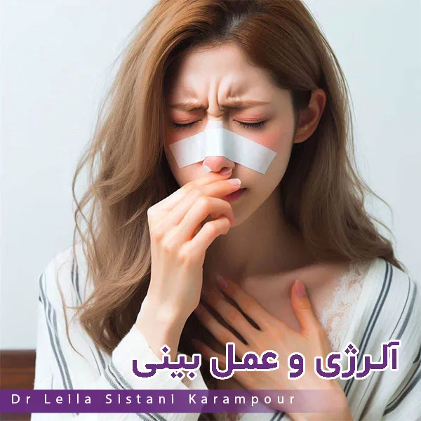 آلرژی و عمل بینی - دکتر لیلا سیستانی کرم پور