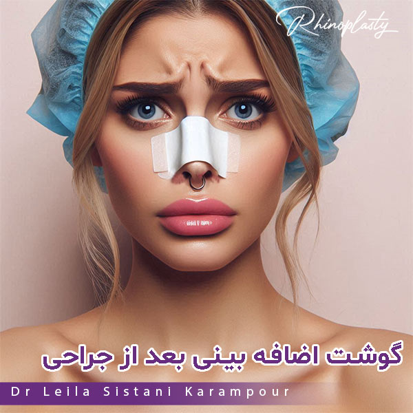 گوشت اضافه بینی بعد از جراحی - دکتر لیلا سیستانی کرم پور