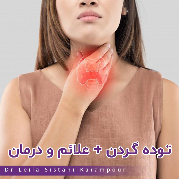 توده گردن - دکتر لیلا سیستانی کرم پور https://drleilasistanikarampour.com/