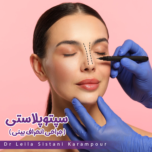 سپتوپلاستی - دکتر لیلا سیستانی کرم پور https://drleilasistanikarampour.com/