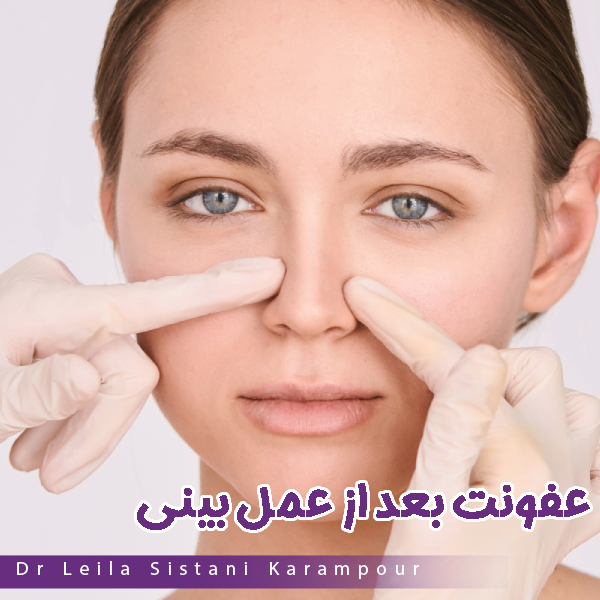 عفونت بعد از عمل بینی - دکتر لیلا سیستانی کرم پور https://drleilasistanikarampour.com/