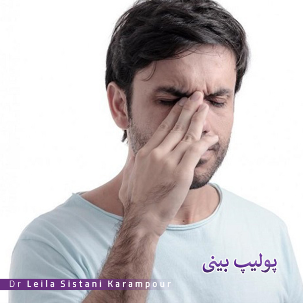درمان پولیپ بینی _ دکتر لیلا سیستانی