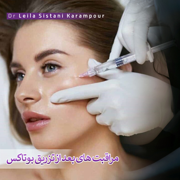 مراقبت های بعد از تزریق بوتاکس _ دکتر لیلا سیستانی