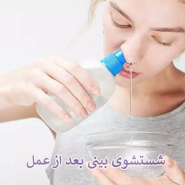 شستشوی بینی بعد از عمل _ دکتر لیلا سیستانی