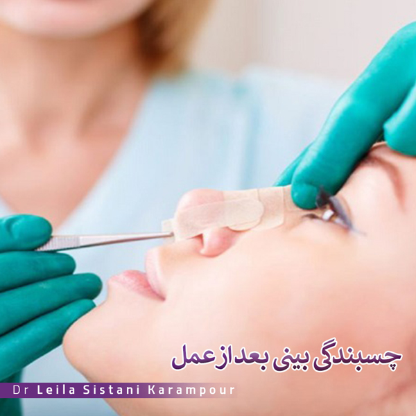 چسبندگی بینی بعد از عمل چیست | دکتر لیلا سیستانی