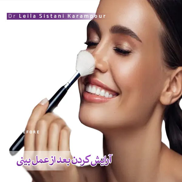آرایش کردن بعد از عمل بینی _ دکتر لیلاسیستانی