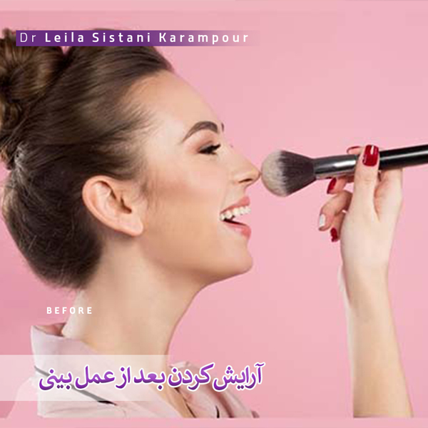 آرایش کردن بعد از عمل بینی _ دکتر لیلاسیستانی