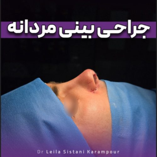 جراحی-بینی-25