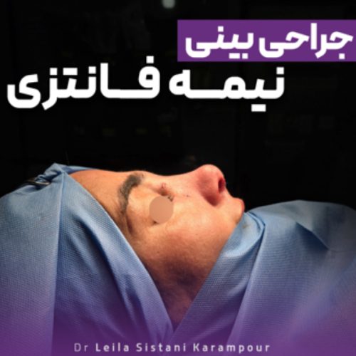جراحی-بینی-27