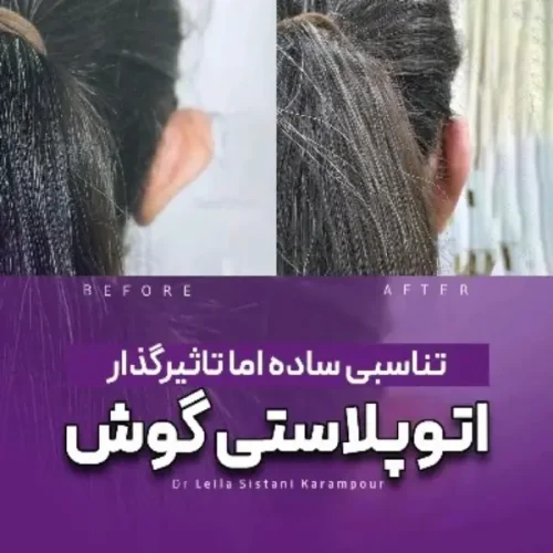 جراحی-گوش-35